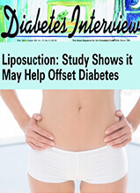 Diabetes Interview: Liposuction Study Shows It May Help Offset Diabetes