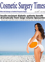 Cosmetic Surgery Times: Insulin-Resistant Diabetic Patients Benefit Dramatically From Large-Volume Liposuction